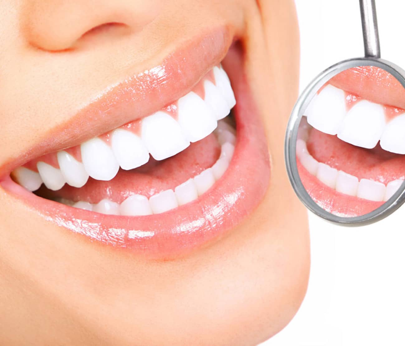 Dentus perfectus - izbjeljivanje zubi