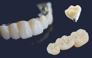 Dentus perfectus - protetika Visokokvalitetna cirkon protetika koja oponaša prirodnu strukturu zuba - Dentus perfectus - zubna protetika