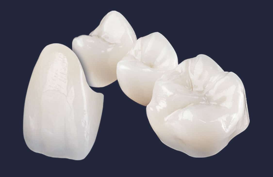 Dentus perfectus - zubne krunice - navlake za zube