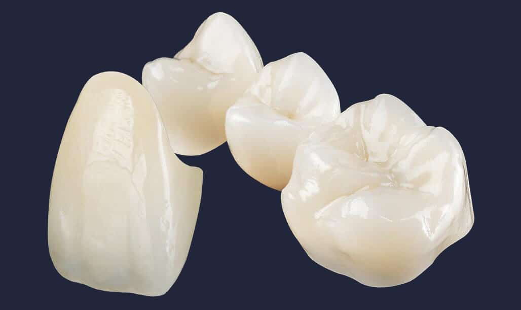 Dentus perfectus - zubne krunice