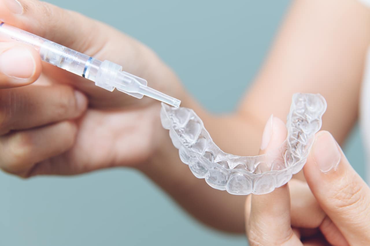 Tooth,Whitening,Gel,Being,Applied,To,A,Tooth,Mold,In vrste izbjeljivanja zubi