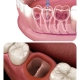 3d prikaz liječenja zuba i vađenja zuba