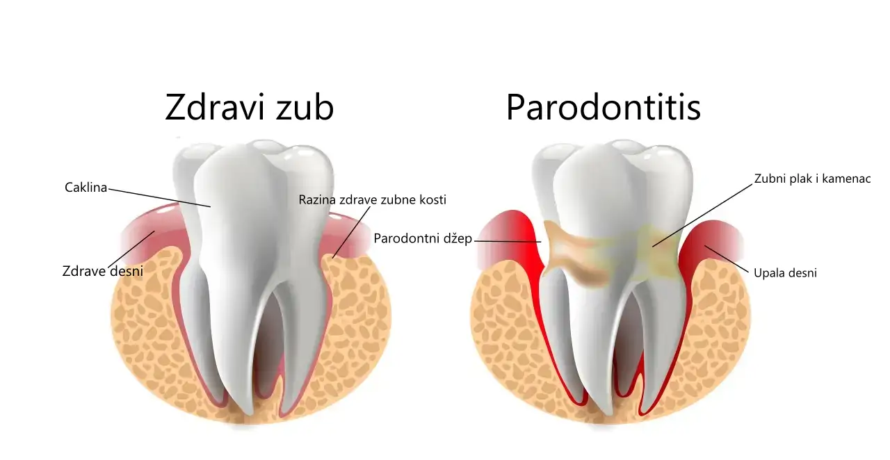 Parodontologija