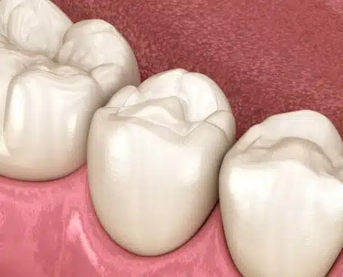 zubobolja