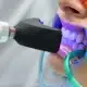 profesionalni proces kako izbijeliti zube