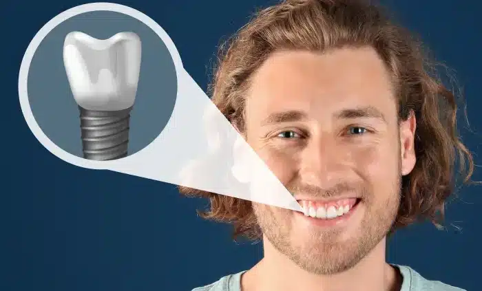 koliko košta jedan zubni implantat