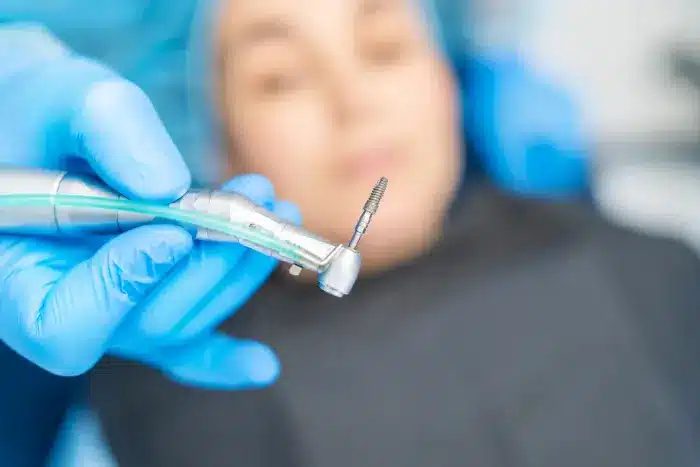 proces ugradnje zubnih implantata