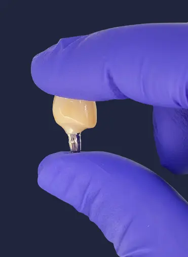 zubna krunica na implantatu
