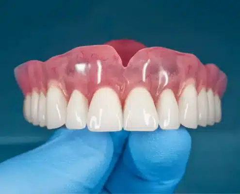 Proteza za zube - Dentus perfectus