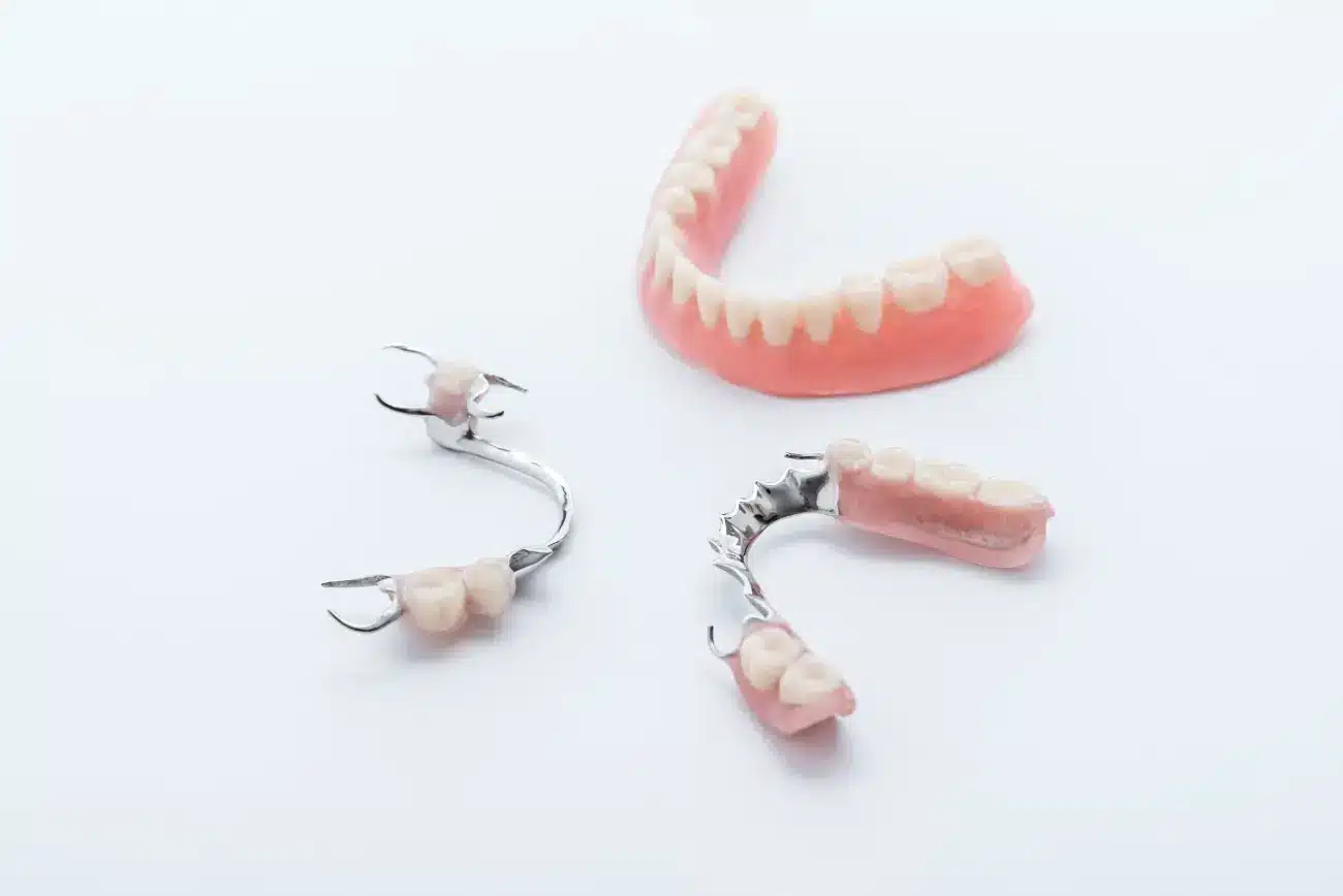 vrste zubne proteze