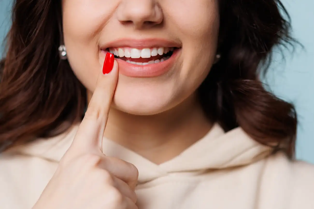 Udlage za izbjeljivanje zubi - Dentus perfectus stomatološka ordinacija Zagreb Udlage za izbjeljivanje zubi - Dentus perfectus stomatološka ordinacija Zagreb