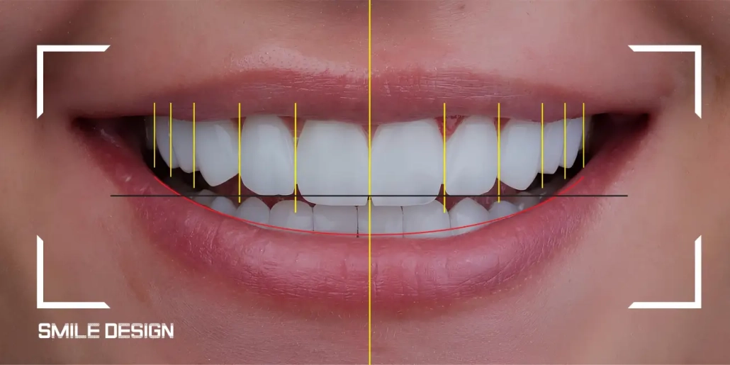 smile design - dentus perfectus dental practice smile design - dentus perfectus dental practice