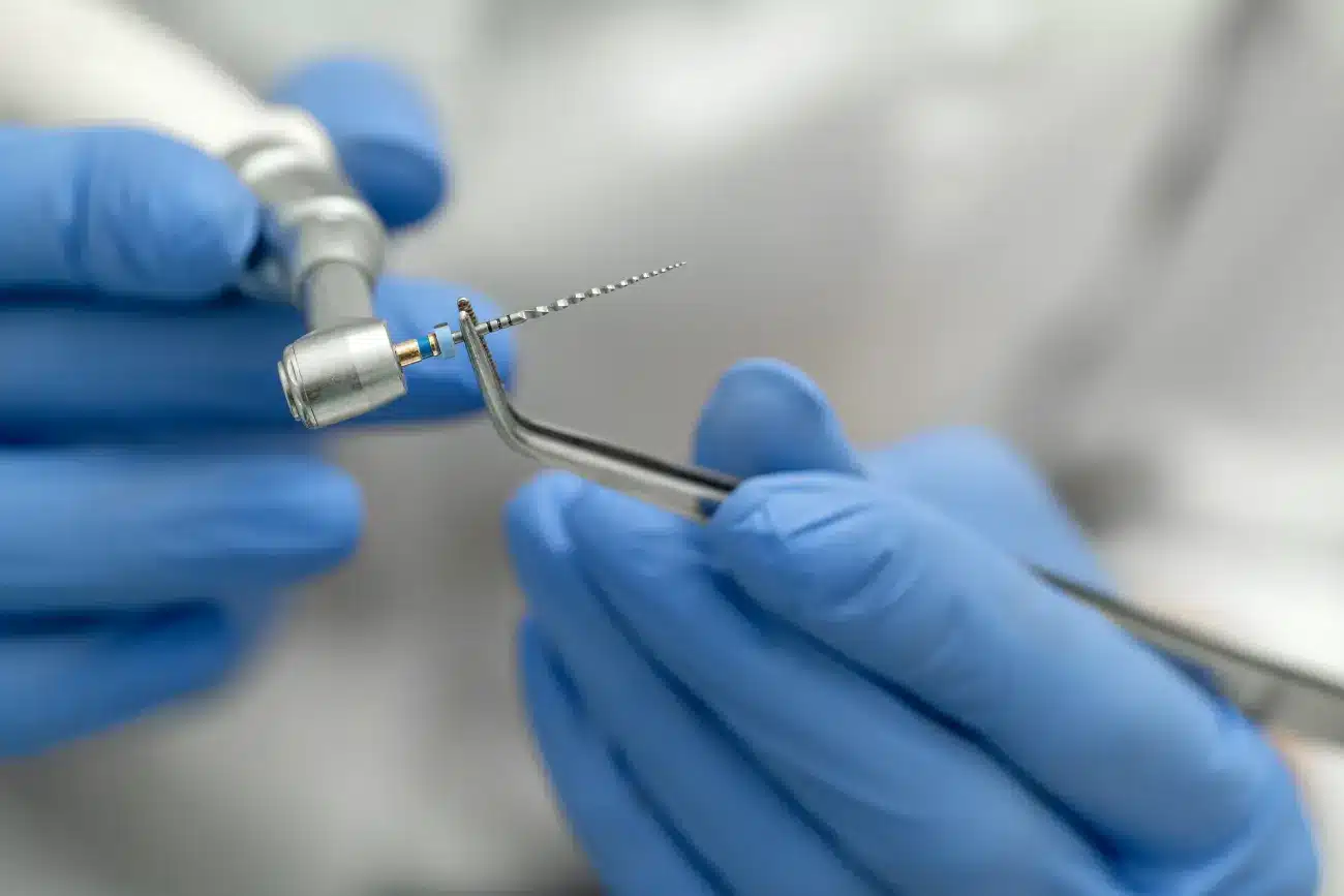 endodonthic treatment