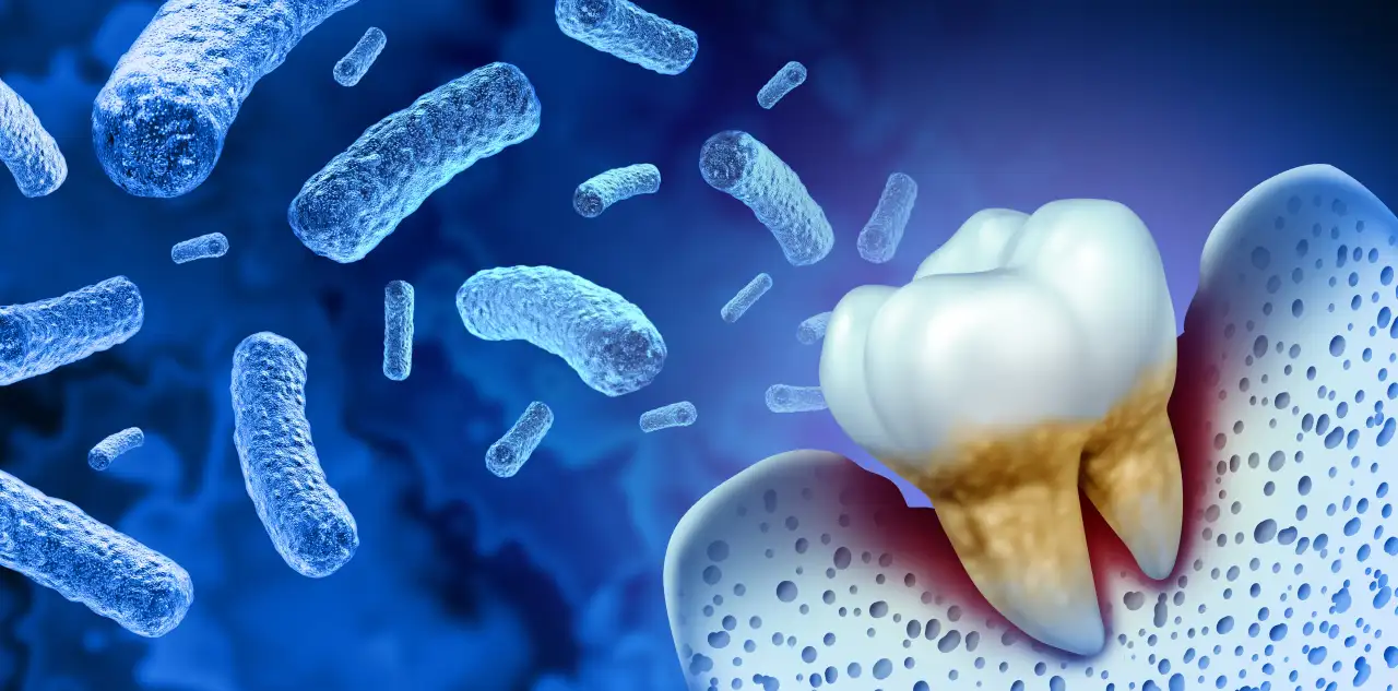 gum disease is caused by the bad bacteria in the mouth