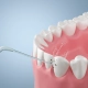 Zapinje mi hrana među zubima - Detaljna 2D ilustracija dvaju zuba s komadićem hrane zaglavljenim u interdentalnom prostoru.
