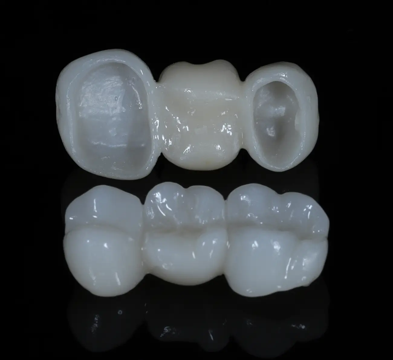 zubni most - 3 člana - Dentus perfectus stomatološka ordinacija slika prikazuje cirkonski zubni most od 3 člana.