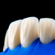 koliko traje izrada zubne krunice? Koliko brzo možete dobiti novi osmijeh uz zubnu krunicu - Dentus perfectus stomatološka ordinacija - Zagreb - Savica