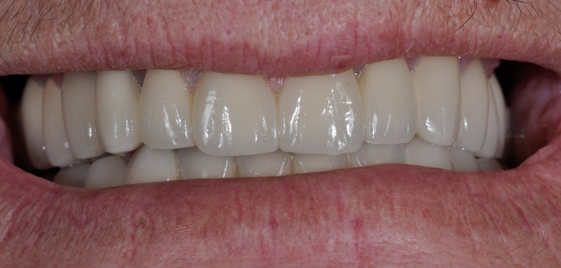After image