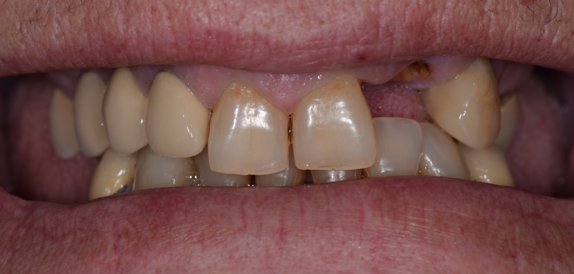 Before image