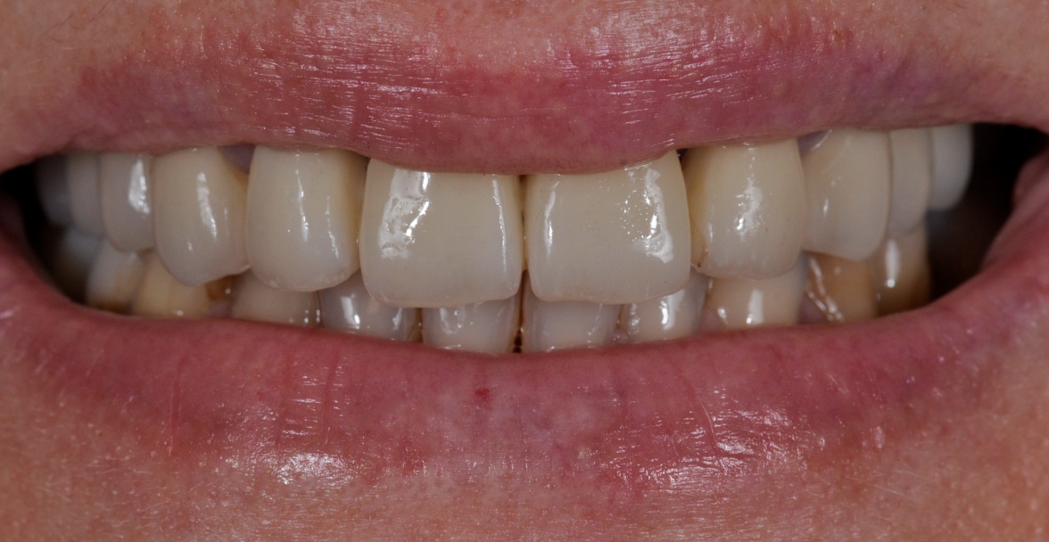 Before image