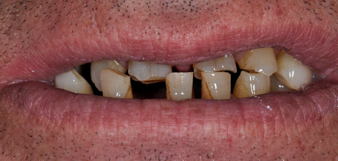 Before image
