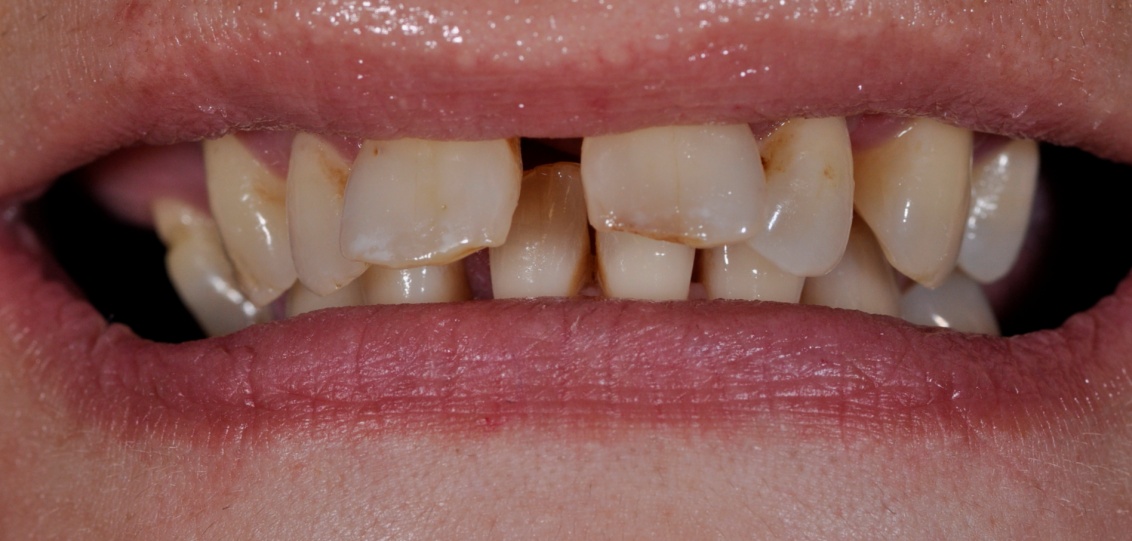 Before image