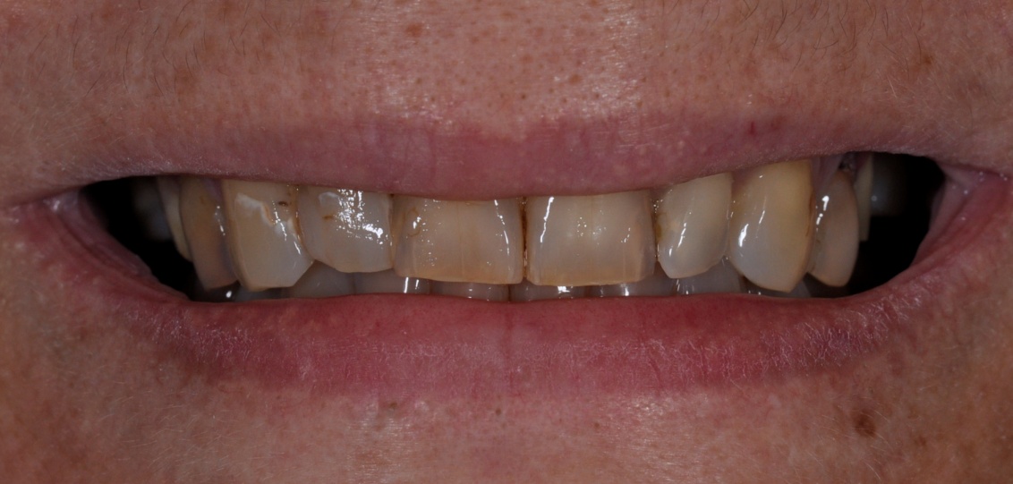 Before image