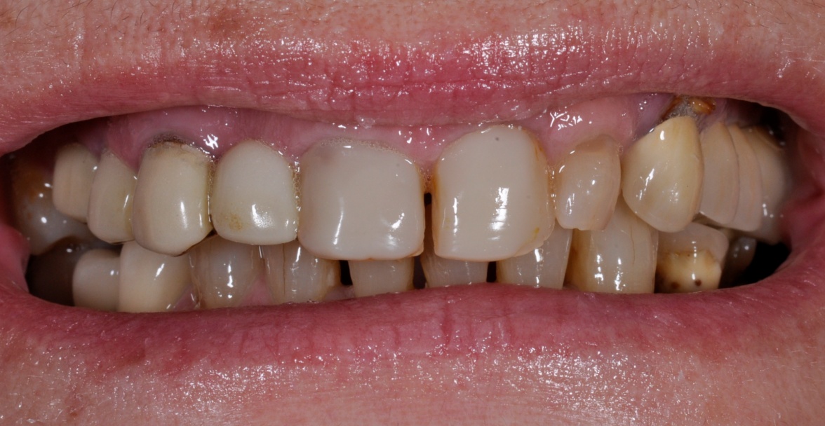 Before image