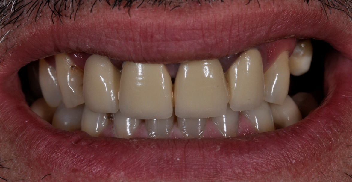 Before image