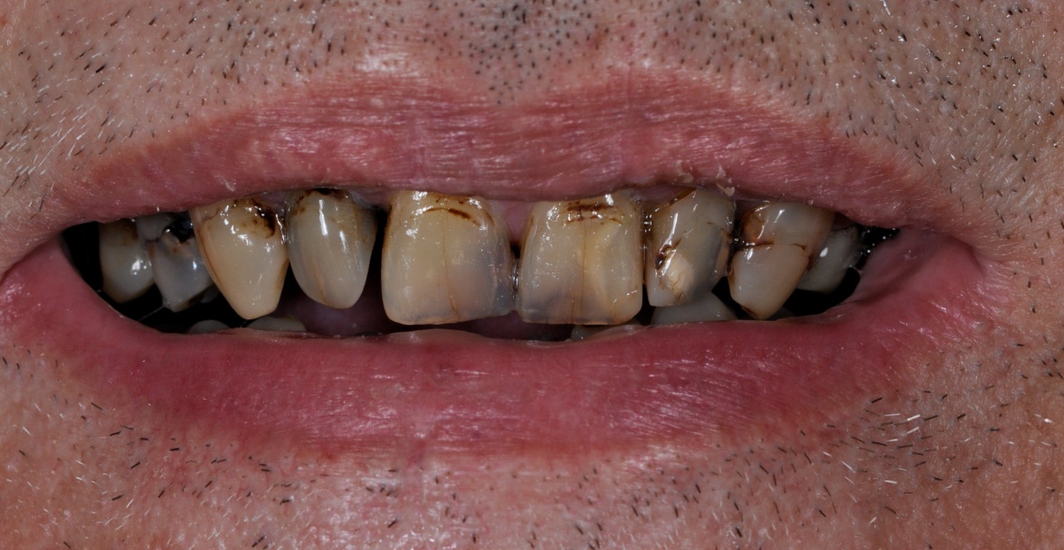 Before image
