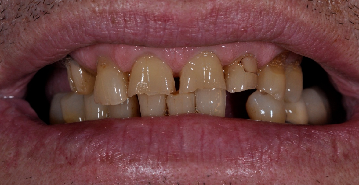 Before image
