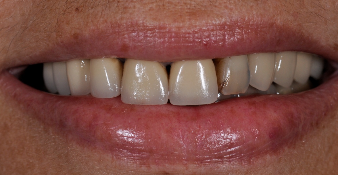 Before image