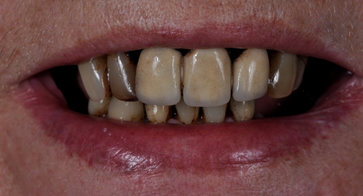 Before image