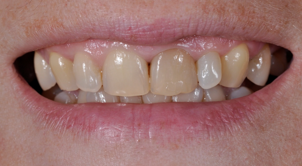 Before image