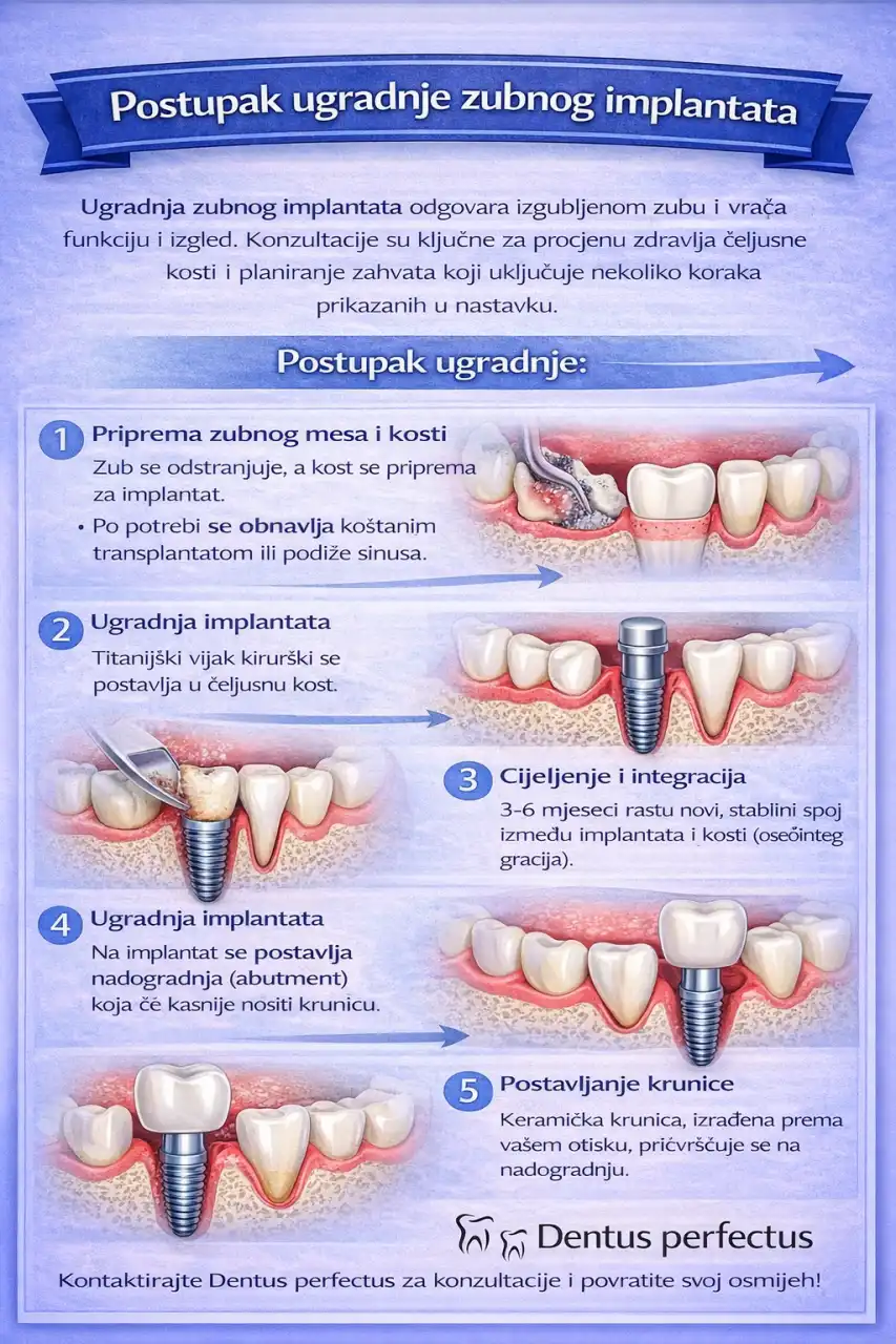 ugradnja implantata ugradnja implantata