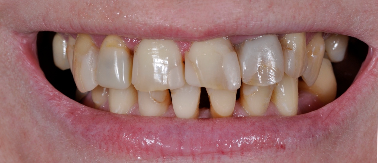 Before image