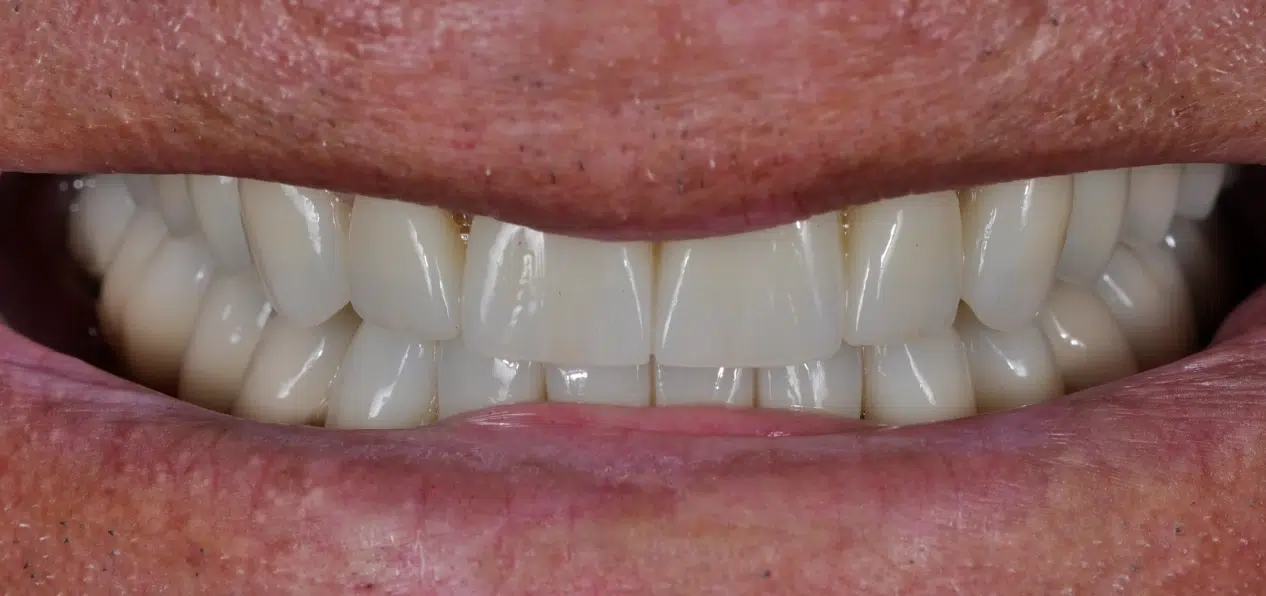 After image