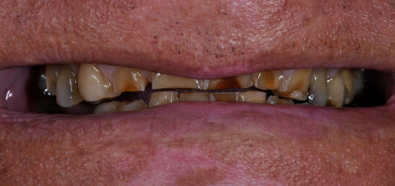Before image