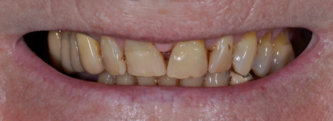 Before image